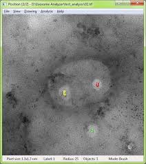 Exosome Analyzers Market