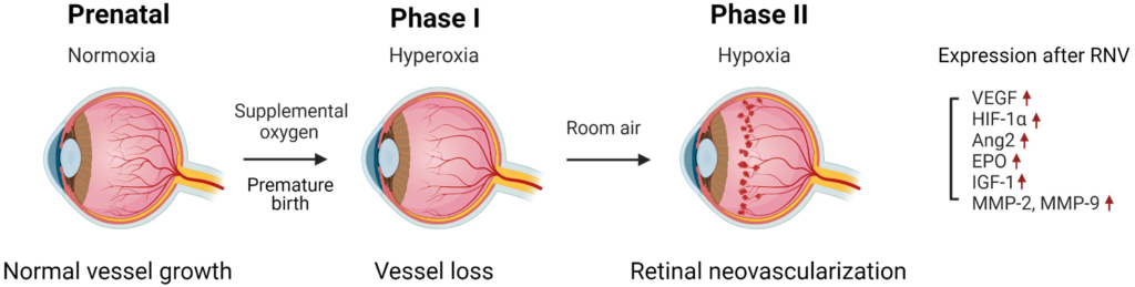 Retinopathy Of Prematurity Therapeutics market