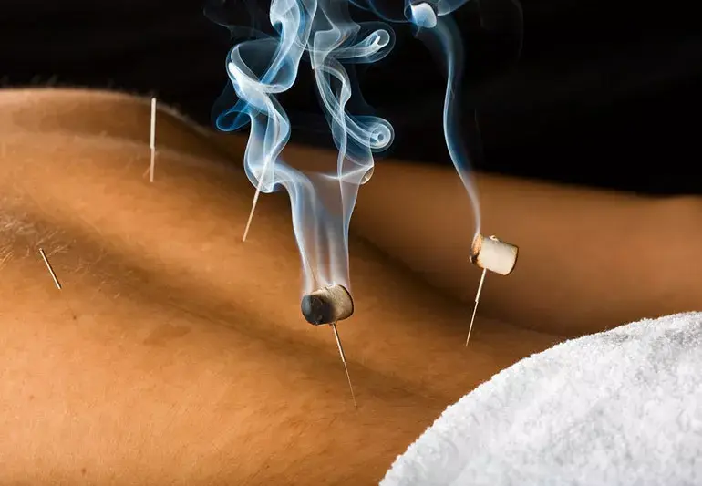 Thermal Moxibustion Instrument Market