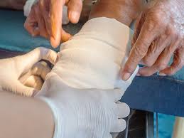 Hydrophilic Wound Dressings Market